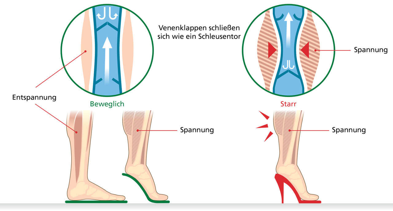 Illustration comparing the effects of flexible leg muscles and vein valves on the left with tension in stiff muscles on the right, including high heel use.