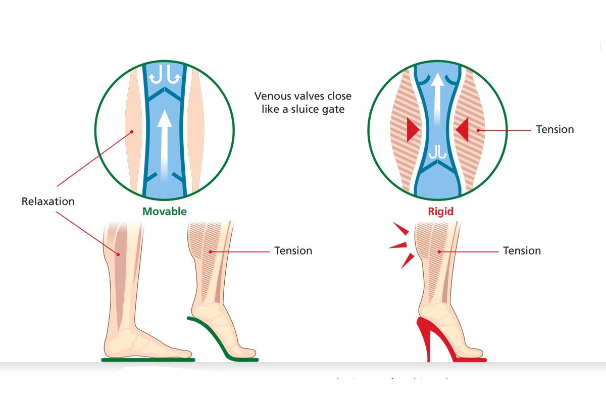 Diagram contrasting leg tension and venous valve operation in flat shoes versus high heels, highlighting relaxation with flat shoes and tension with high heels.