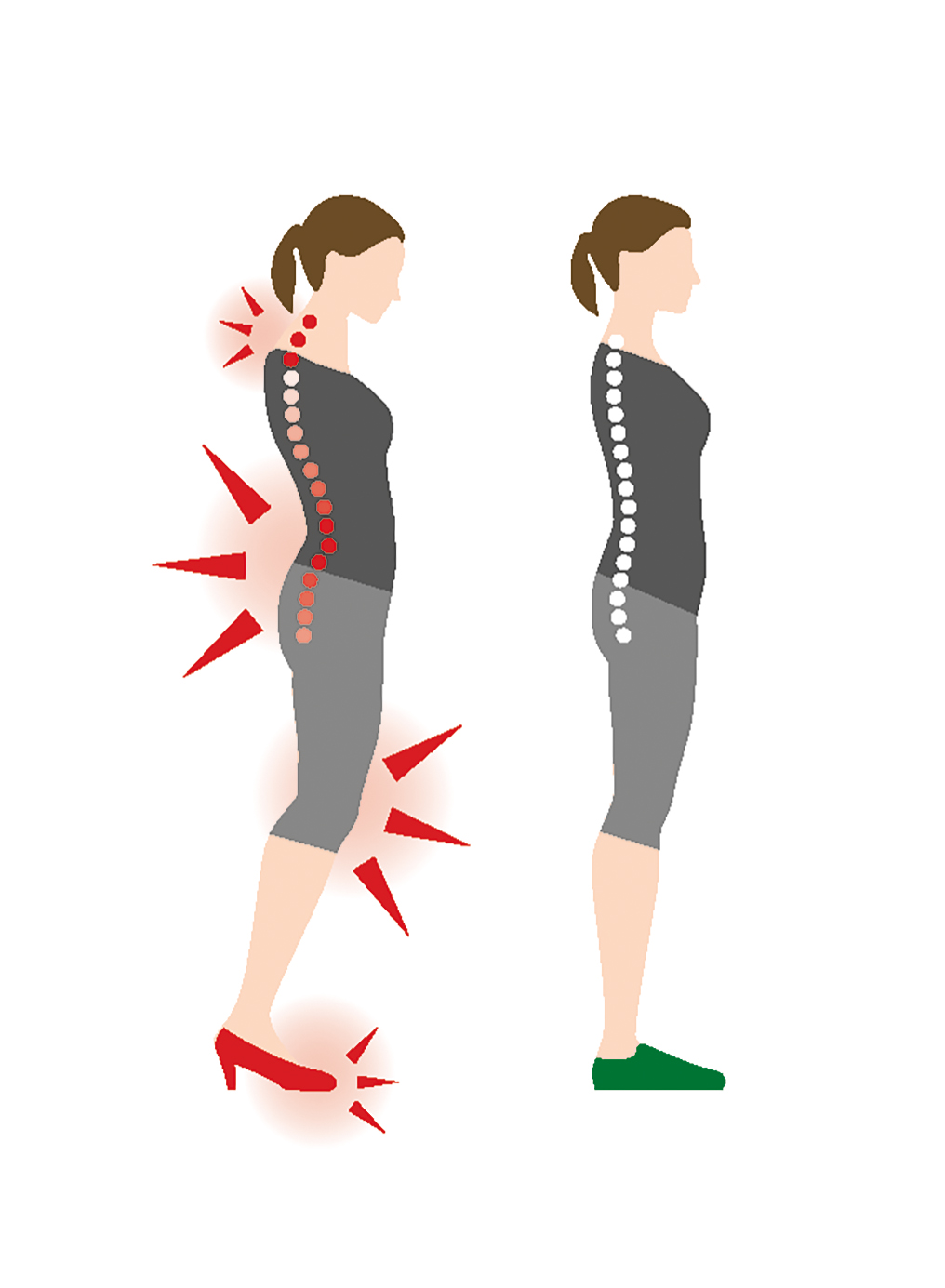 Illustration showing the effect of high heels versus flat shoes on spine alignment and posture. The left figure depicts incorrect posture with high heels, causing back pain, while the right figure shows correct posture with flat shoes.